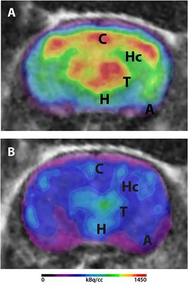 18F-FDG-PET in Mouse Models of Alzheimer's Disease